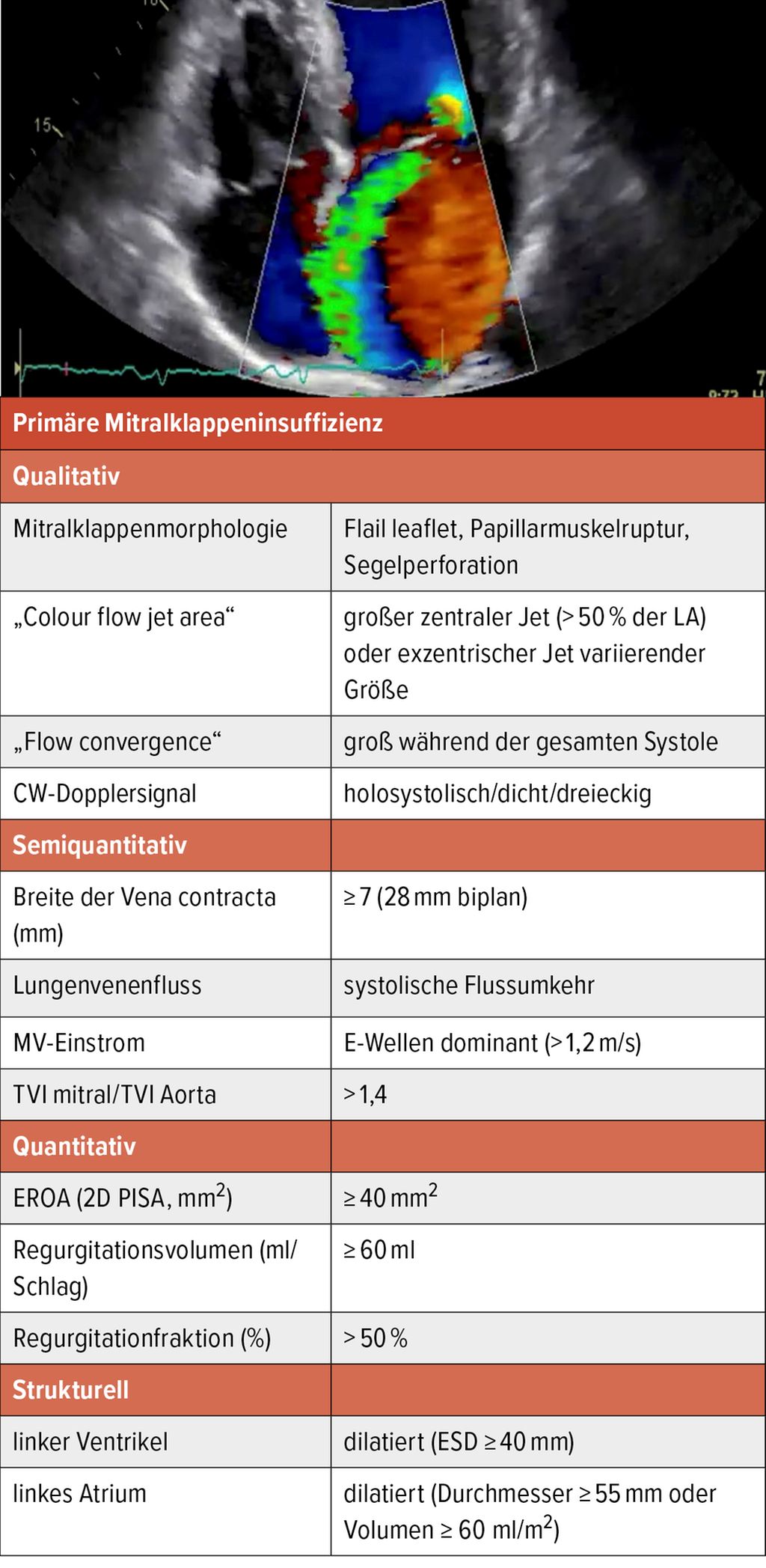 Quantifizierung & interventionelle Therapie der Mitralklappeninsuffizi